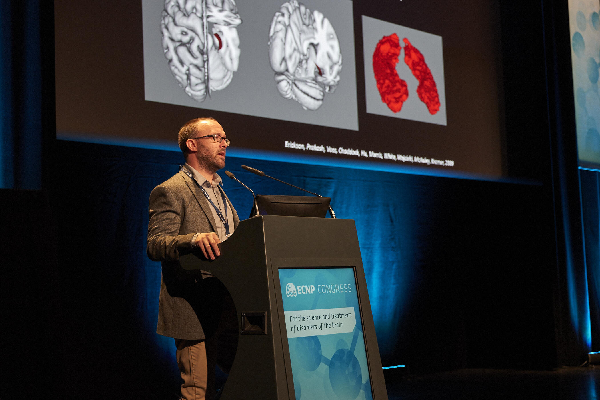 Kirk Erikson on Excersice and psychiatric disease Kirk Erikson talking